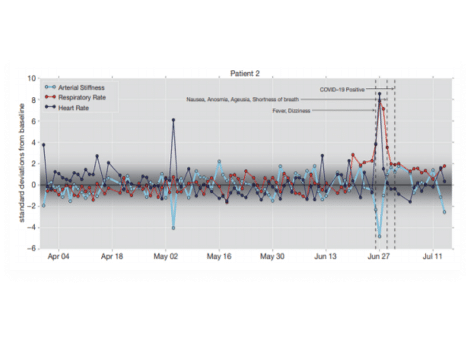 Graph showing arterial stiffness, respiratory rate, HRV, and heart rate deviations from baseline for Patient 2 between April 4 and July 11. COVID-19 positive indicated around late June. Symptoms annotated include nausea, anosmia, ageusia, shortness of breath, fever, and dizziness.